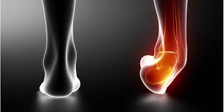 How to Prevent Ankle Injuries in Basketball