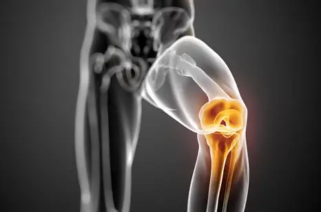 The ACL-Deficient Knee: A Problem Solving Approach