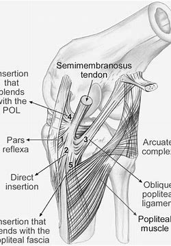 The High Posterolateral Portal (HPLP): Advancing Precision in Knee Arthroscopy