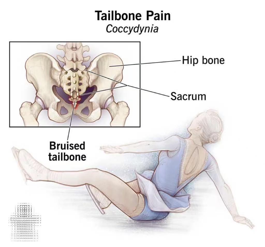 How to Protect the Tailbone（Coccyx） from Injury During Exercise