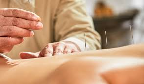 The Role of Traditional Chinese Medicine in Sports Rehabilitation: Acupuncture, Tuina, and Physical Therapy